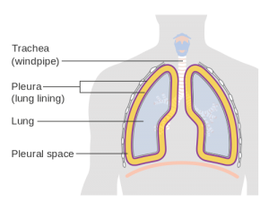 Diagram_showing_the_lining_of_the_lungs_(the_pleura)_CRUK_306.svg